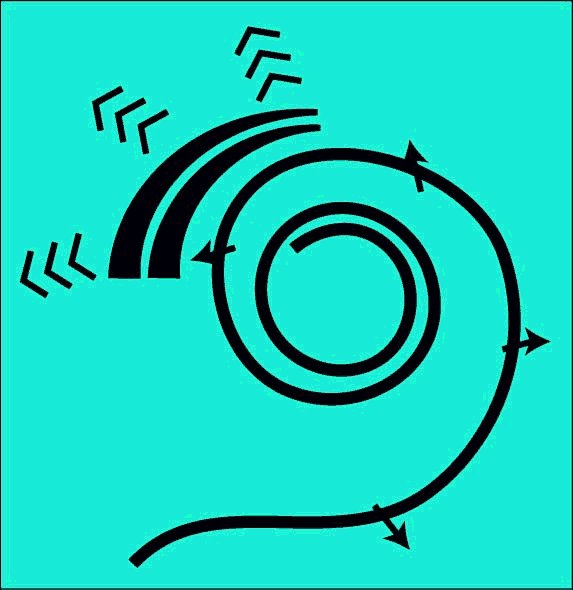 Caricature of Cochlea Operation
