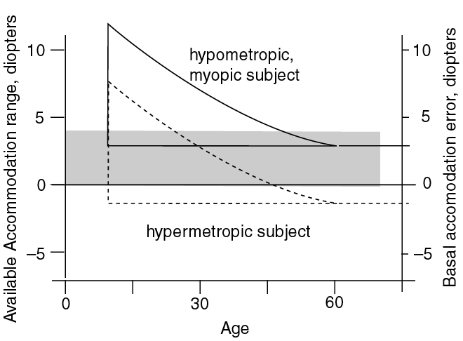 Progression of Ametropia with age.