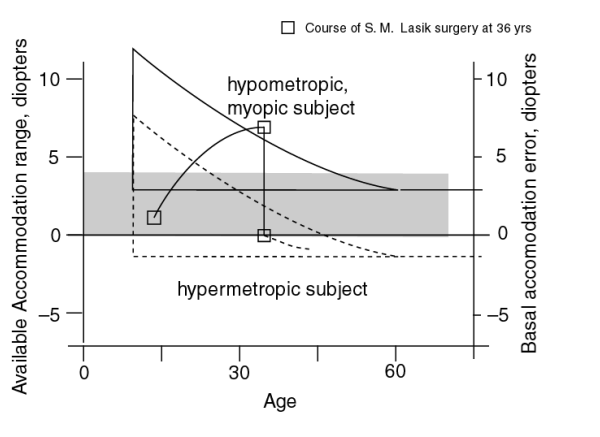 Progression of Ametropia with surgical intervention.